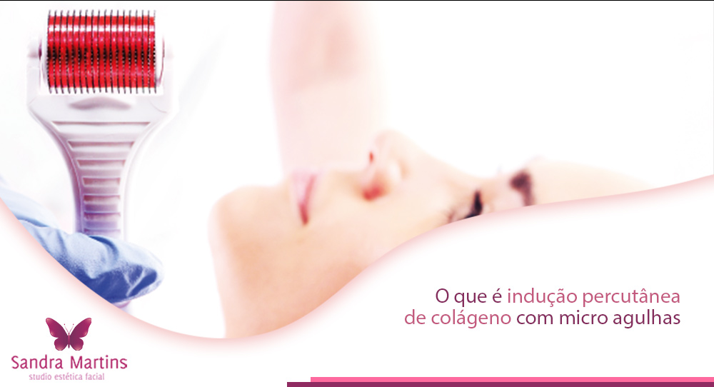 Onde fazer em Brasília e o que é a indução percutânea de colágeno (IPCA) ou comumente chamada do microagulhamento ou microneedling. Conheça Sandra Martins
