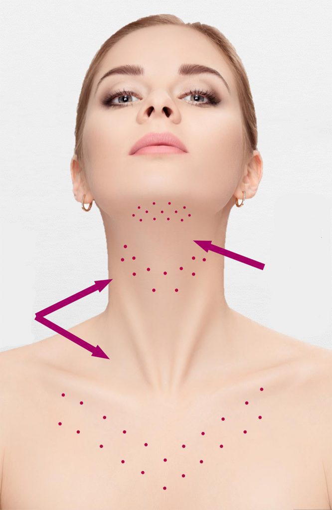 Conheça o revolucionário tratamento estético facial de microagulhamento para harmonização de papada e de lifting de pescoço e colo do Studio Sandra Martins em Brasília