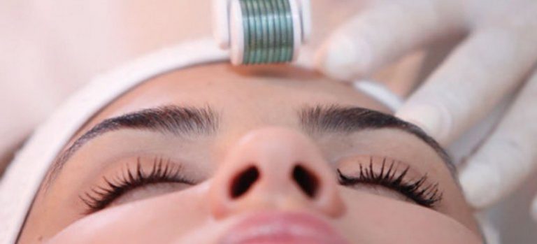 Conheça o Microagulhamento: o novo método para rejuvenescimento da pele, onde Sandra Martins, já realiza desde 2014 em Brasília em seus pacientes!