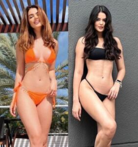 Eslovênia, ex-BBB, se rendeu a esse modelo de lipo e o TikTok está cheio de cirurgiões falando sobre ela. Mas será que vale a pena