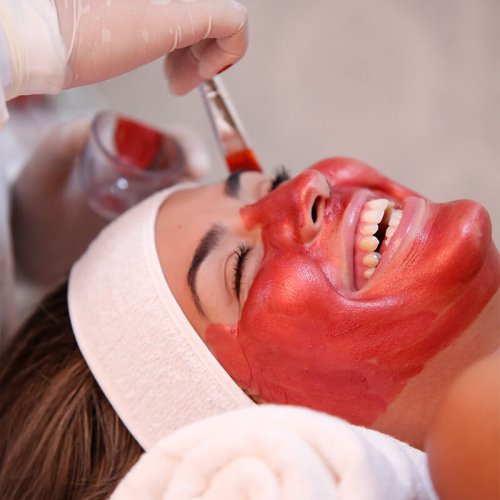 clareamento-facial-mancha-melasma-sandra-martins-melhor-brasilia-1 clareamento-facial-mancha-melasma-sandra-martins-melhor-brasilia-1